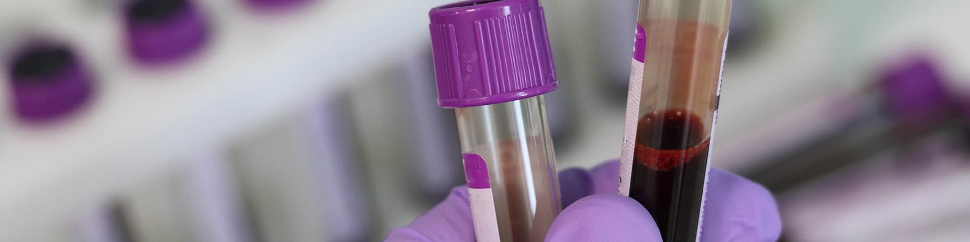 Mobility Schemes - Science and Language Mobility Scheme Africa banner